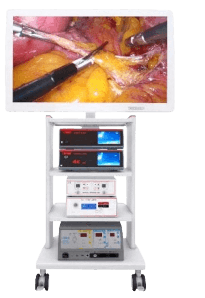 Lithotripsy System